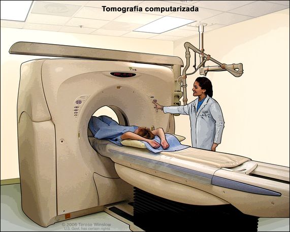 Tomograf A Para Qu Sirve