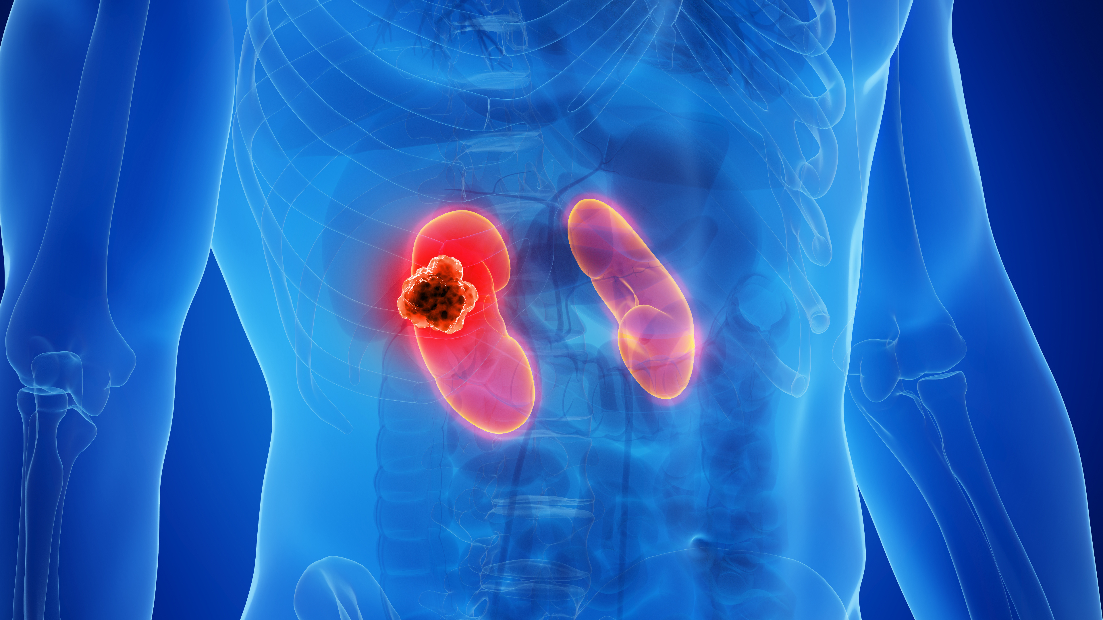 Comunidad MiMed Oncología 09 de marzo 2024